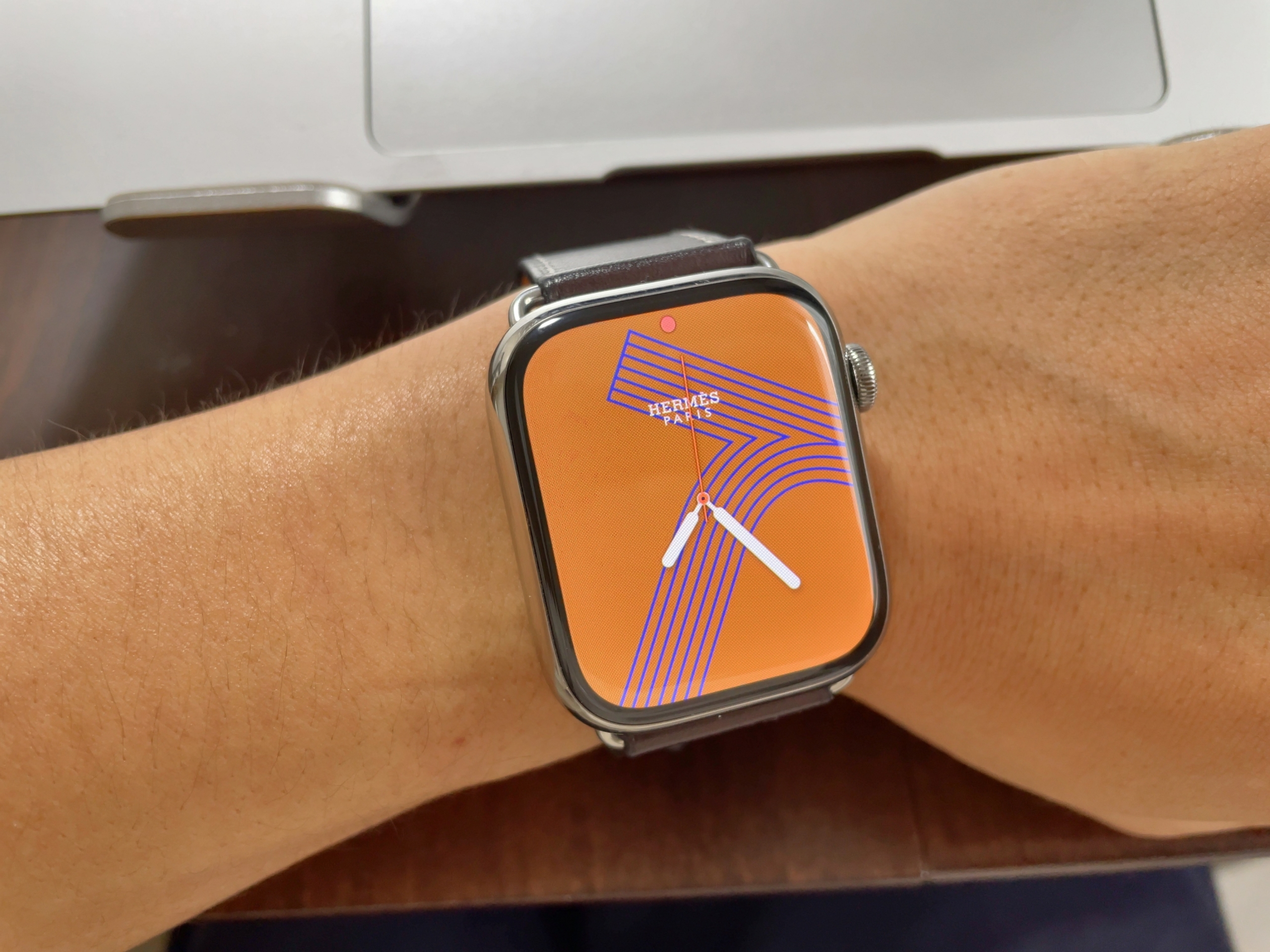 愛用者目線】シリーズ７を一年使ってわかったAppleWatch HERMESの 